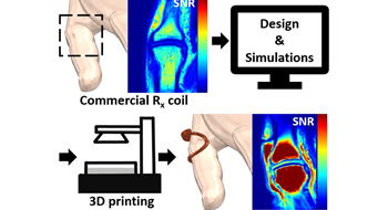 Additive Manufacturing of Subject-Conformal Receive Coils for MRI @Adv. Mat. Tech.!