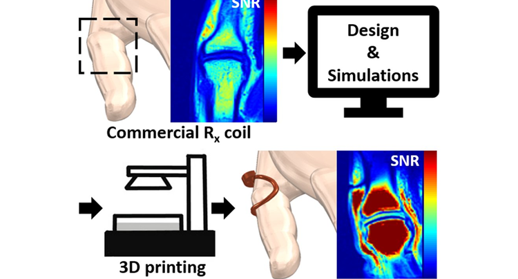 Additive Manufacturing of Subject-Conformal Receive Coils for MRI @Adv. Mat. Tech.!